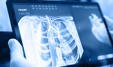 Research: A Streamlined AI System for Automated Diagnosis of Pulmonary Embolism using Chest Images AI101
