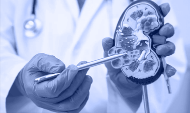 Talk : Precision Immunosuppression in Kidney Transplantation: Moving Beyond “Average” Tacrolimus Dosing