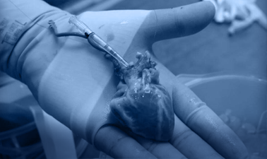 Talk : First Regional Ex Situ animal model Heart Perfusion: A Milestone Toward Heart Transplantation in Egypt