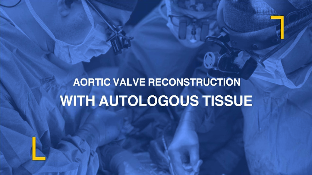 Talk : World’s First Successful Aortic Valve Reconstruction with Autologous Tissues: A Landmark in Cardiac Surgery Talk89