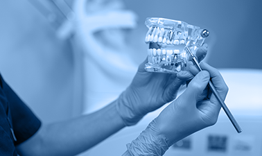 Accuracy Of Digital And Conventional Implant-level Impression Techniques For Maxillary Full-arch Screw-retained Prosthesis: A Crossover Randomized Trial